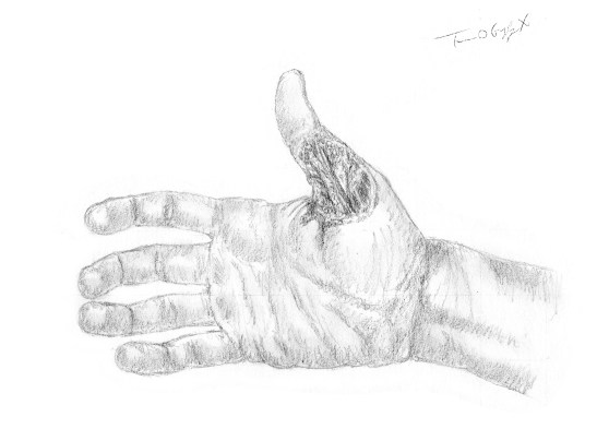 injection sous pression main