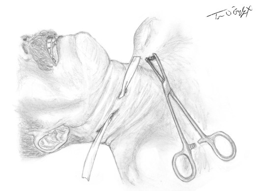 plaie cervicale superficielle