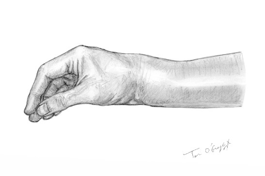 fracture Pouteau Colles