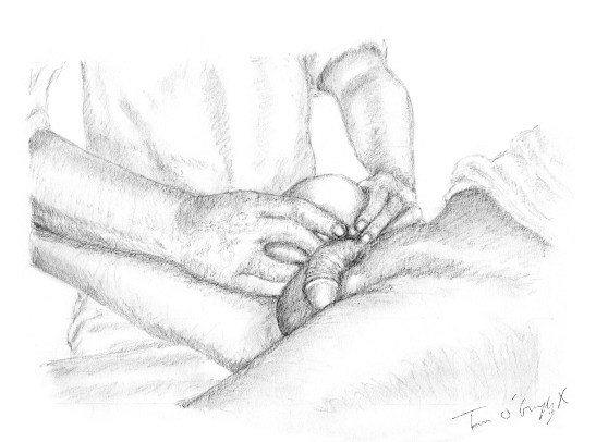 reduction taxis hernie inguinale