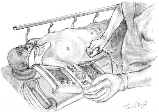 echographie ciblee urgence FAST ultrasound