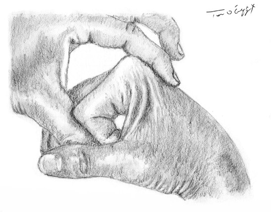 fracture metacarpien reduction