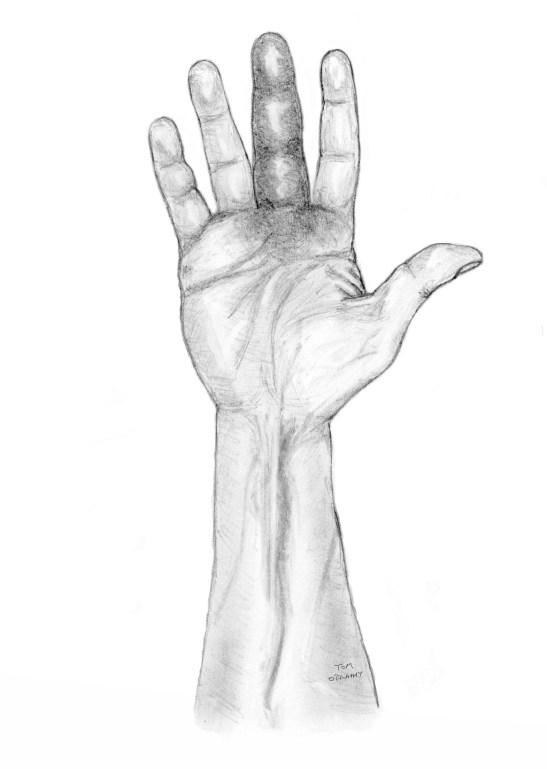 phlegmon gaines synoviales main