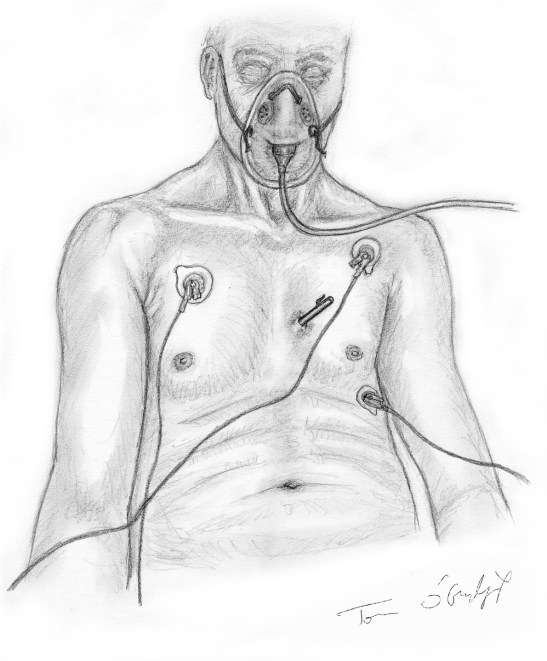 plaie thorax superficielle