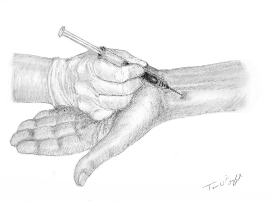 gaz du sang arteriel