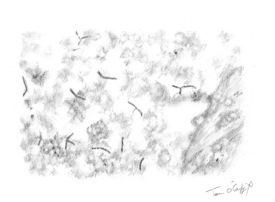 tuberculose pulmonaire bacides de Koch