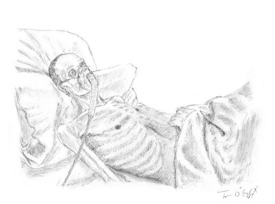 tuberculose pulmonaire cachexie