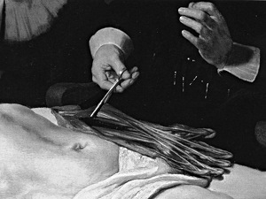 leçon d'anatomie du Dr Tulp, Rembrandt