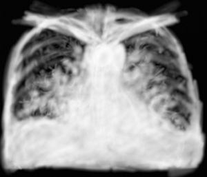 RP OAP avant traitement