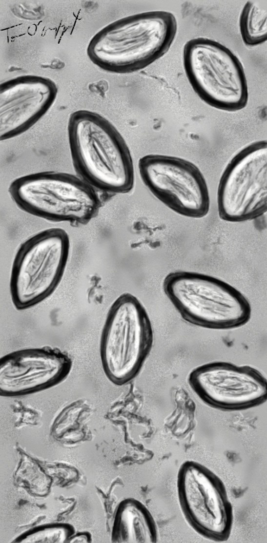 oxyures oeufs scotch test