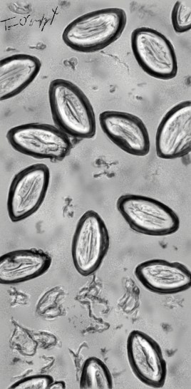 oxyures oeufs scotch test