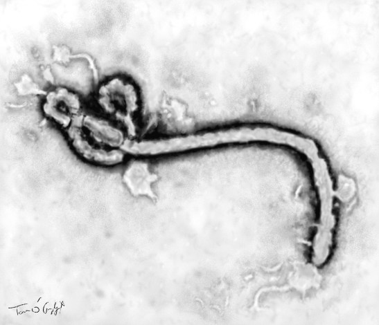Ebola virus microscopie
