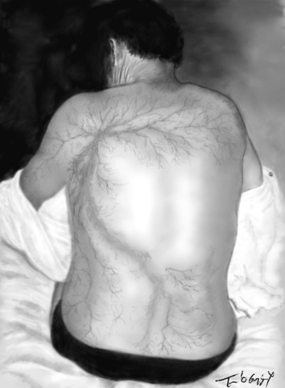 foudroiement figure Lichtenberg