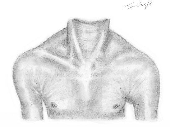 luxation sterno costo claviculaire