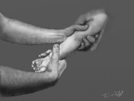 pronation douloureuse reduction