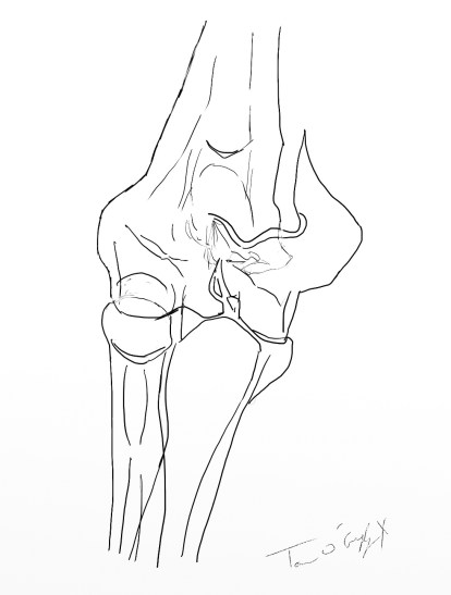 palette humerale radiographie