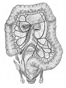 artere mesenterique superieure inferieure colon Netter artères mésentériques supérieure et inférieure vascularisant le colon