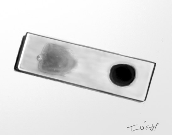 paludisme frottis goutte epaisse