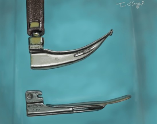 intubation tracheale laryngoscope Miller Macintosh