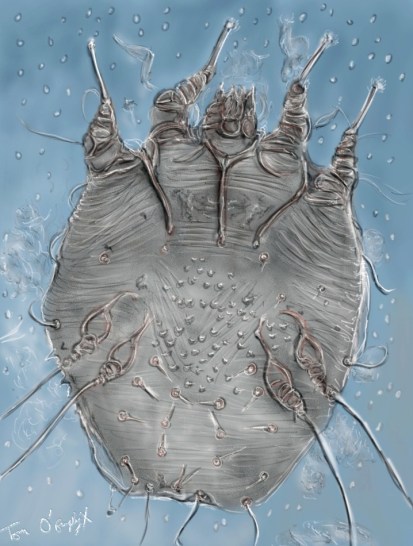 gale sarcoptes scabei