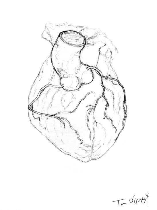 arteres coronaires coeur