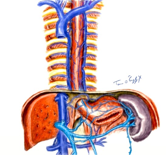 veines-oesophage-varices