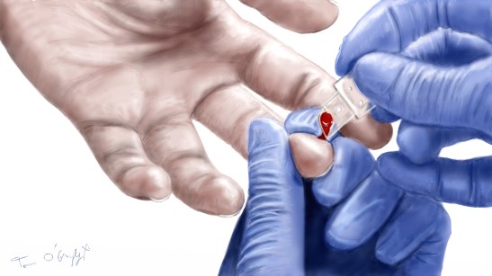 choc hemorragique hemocue