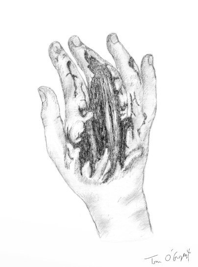 morsure main perte de substance