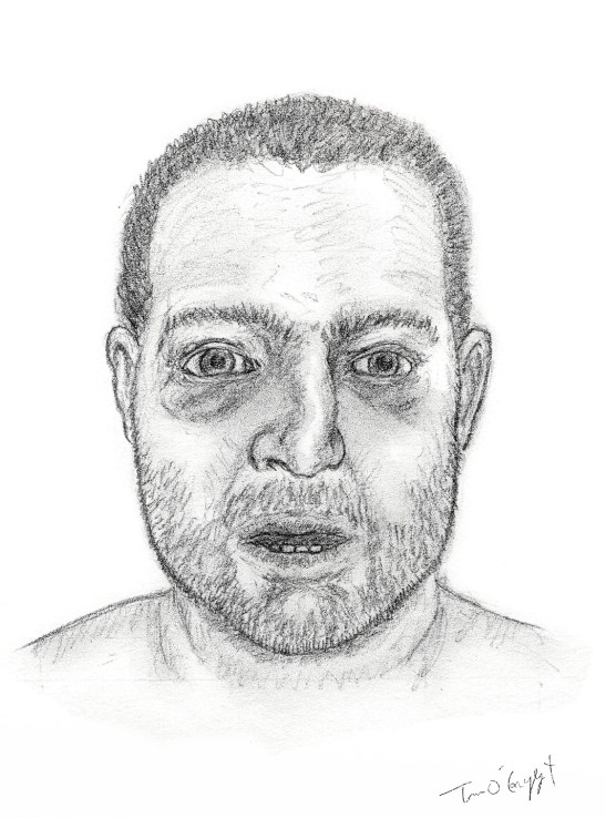 fracture os propres du nez