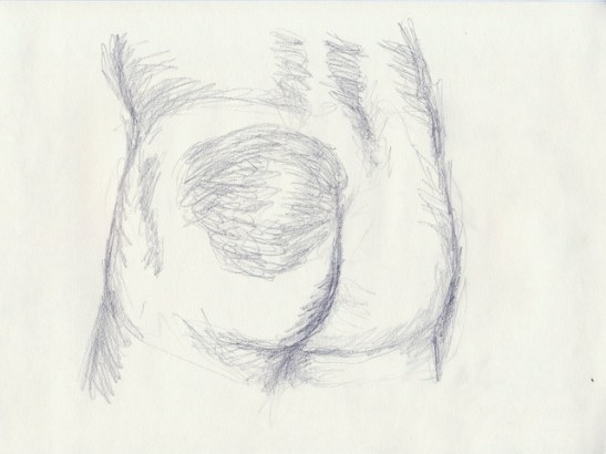 hematome parties molles1