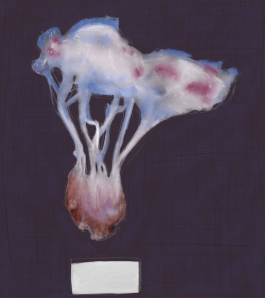 rupture papillaire 2