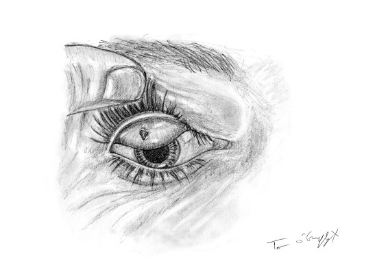 corps etranger conjonctival