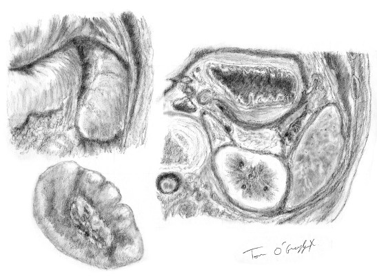 rate rapports coupes anatomiques